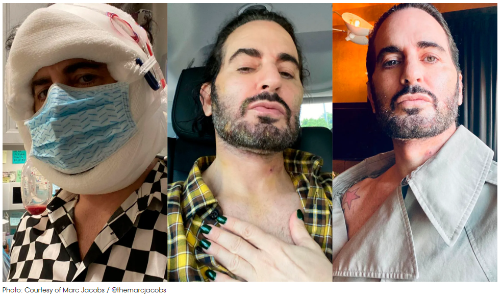 Man beofre and after surgery